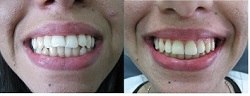 B & A 2